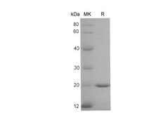 LCN2 / Lipocalin 2 / NGAL Protein - Recombinant Mouse NGAL/LCN2 Protein (His Tag)-Elabsicence