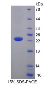 Lcn5 / Lipocalin 5 Protein - Recombinant  Lipocalin 5 By SDS-PAGE