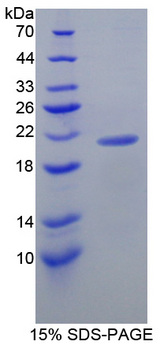 LCN8 Protein - Recombinant  Lipocalin 8 By SDS-PAGE