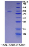LCP2 / SLP-76 Protein - Recombinant Lymphocyte Cytosolic Protein 2 By SDS-PAGE
