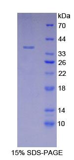 LDHA / LDH1 Protein - Recombinant Lactate Dehydrogenase A By SDS-PAGE