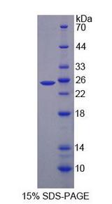 LDLR / LDL Receptor Protein - Recombinant Low Density Lipoprotein Receptor (LDLR) by SDS-PAGE
