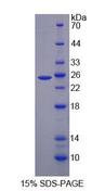 LDLR / LDL Receptor Protein - Recombinant Low Density Lipoprotein Receptor (LDLR) by SDS-PAGE