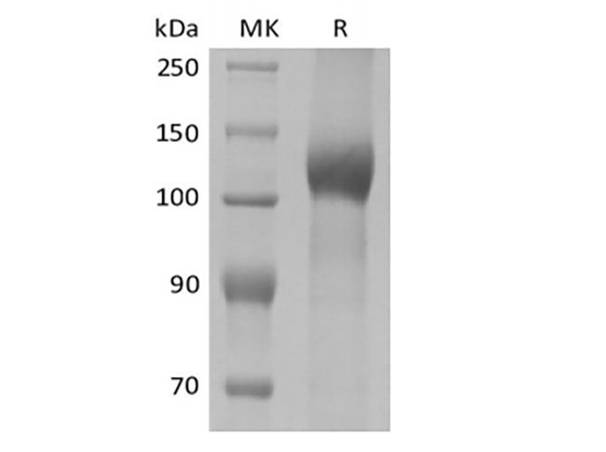 LEPR / Leptin Receptor Protein - Recombinant Mouse Leptin Receptor/LEPR/CD295 (C-10His)
