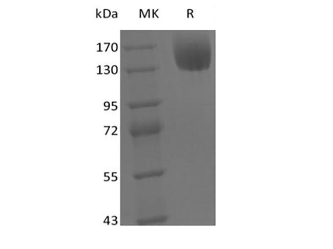 LEPR / Leptin Receptor Protein - Recombinant Mouse Leptin Receptor/LEPR/CD295 (C-Fc)