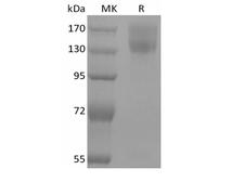 LEPR / Leptin Receptor Protein - Recombinant Mouse Leptin Receptor/LEPR/CD295 (C-mFc)