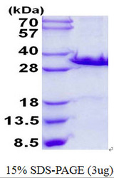 LGALS3 / Galectin 3 Protein