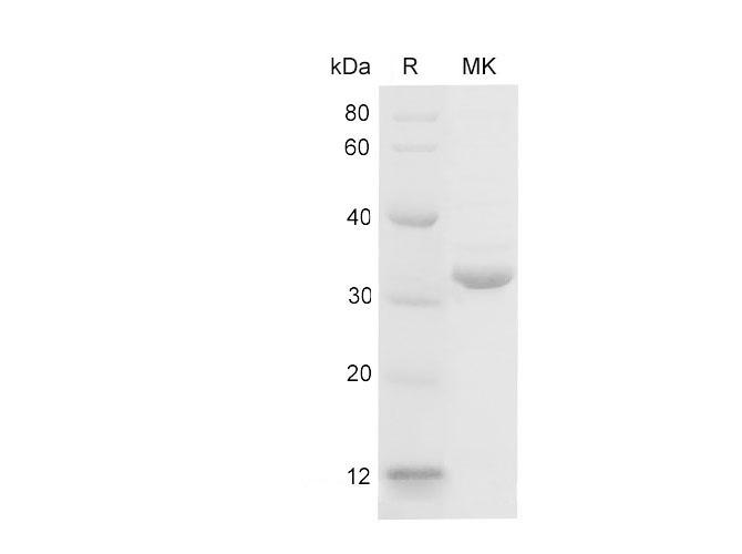 LGALS3 / Galectin 3 Protein - Recombinant Mouse Galectin-3/Lgals3 protein (His Tag)