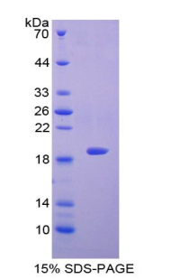 LGALS7 / Galectin 7 Protein - Recombinant Galectin 7 By SDS-PAGE