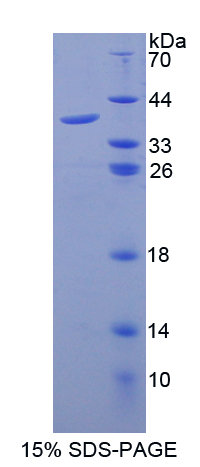 LGALS8 / Galectin 8 Protein - Recombinant  Galectin 8 By SDS-PAGE