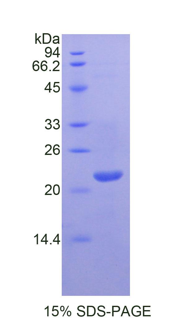 LIF Protein - Recombinant Leukemia Inhibitory Factor By SDS-PAGE