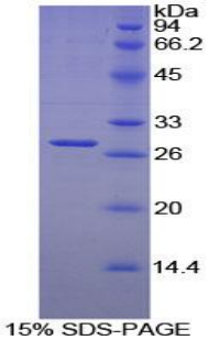 LILRB3 Protein - Recombinant Leukocyte Immunoglobulin Like Receptor Subfamily B, Member 3 By SDS-PAGE