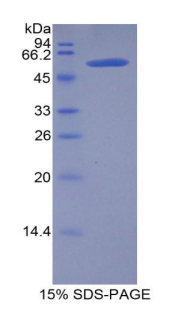 LIPC / Hepatic Lipase Protein - Recombinant Lipase, Hepatic By SDS-PAGE