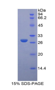LOXL3 Protein - Recombinant Lysyl Oxidase Like Protein 3 By SDS-PAGE