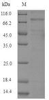 LOXL4 / LOXC Protein - (Tris-Glycine gel) Discontinuous SDS-PAGE (reduced) with 5% enrichment gel and 15% separation gel.
