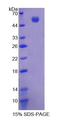 LPCAT1 / AYTL2 Protein - Recombinant  Lysophosphatidylcholine Acyltransferase 1 By SDS-PAGE