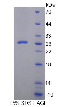 LPXN / Leupaxin Protein - Recombinant Leupaxin By SDS-PAGE