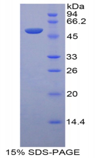 LRG1 / LRG Protein - Recombinant Leucine Rich Alpha-2-Glycoprotein 1 By SDS-PAGE