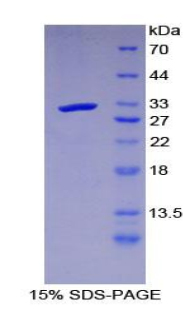 LRIG3 Protein - Recombinant Leucine Rich Repeats And Immunoglobulin Like Domains Protein 3 By SDS-PAGE