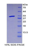 LRIG3 Protein - Recombinant Leucine Rich Repeats And Immunoglobulin Like Domains Protein 3 By SDS-PAGE