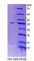LRP1B Protein - Recombinant Low Density Lipoprotein Receptor Related Protein 1B (LRP1B) by SDS-PAGE