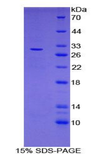 LRRC32 Protein - Recombinant Leucine Rich Repeat Containing Protein 32 By SDS-PAGE