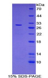 LRRC32 Protein - Recombinant Leucine Rich Repeat Containing Protein 32 By SDS-PAGE