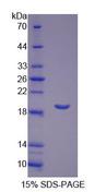 LTA4H / LTA4 Protein - Recombinant  Leukotriene A4 Hydrolase By SDS-PAGE