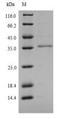 Ly6c1 Protein - (Tris-Glycine gel) Discontinuous SDS-PAGE (reduced) with 5% enrichment gel and 15% separation gel.