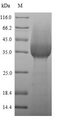 Ly6g / Gr1 Protein - (Tris-Glycine gel) Discontinuous SDS-PAGE (reduced) with 5% enrichment gel and 15% separation gel.