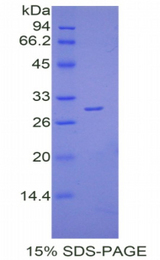 LY9 / CD229 Protein - Recombinant Lymphocyte Antigen 9 By SDS-PAGE