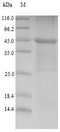 LY96 / MD2 / MD-2 Protein - (Tris-Glycine gel) Discontinuous SDS-PAGE (reduced) with 5% enrichment gel and 15% separation gel.