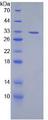 Lymphotoxin-Beta / LTB Protein - Recombinant Lymphotoxin Beta By SDS-PAGE