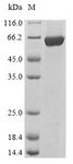 LYN Protein - (Tris-Glycine gel) Discontinuous SDS-PAGE (reduced) with 5% enrichment gel and 15% separation gel.