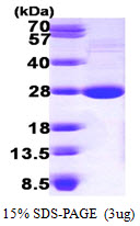 LYPLA1 Protein