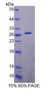 LYPLA1 Protein - Recombinant Lysophospholipase I By SDS-PAGE