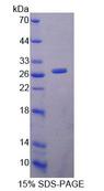 LYPLA1 Protein - Recombinant Lysophospholipase I By SDS-PAGE