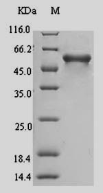 MAdCAM-1 Protein - (Tris-Glycine gel) Discontinuous SDS-PAGE (reduced) with 5% enrichment gel and 15% separation gel.