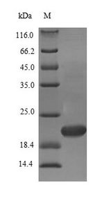 MAFK Protein - (Tris-Glycine gel) Discontinuous SDS-PAGE (reduced) with 5% enrichment gel and 15% separation gel.