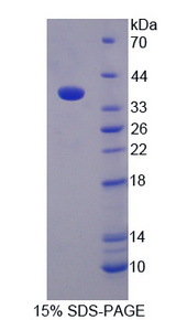 MAOB / Monoamine Oxidase B Protein - Recombinant Monoamine Oxidase B By SDS-PAGE