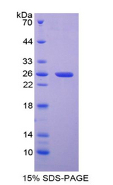 MAP1L / MAP1A Protein - Recombinant Microtubule Associated Protein 1A By SDS-PAGE