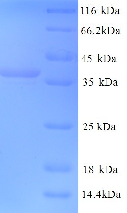 MAP2 Protein