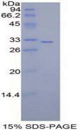 MAP2K7 / MEK7 Protein - Recombinant Mitogen Activated Protein Kinase Kinase 7 By SDS-PAGE