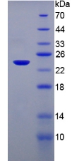 MAP3K7CL / TAK1L Protein - Recombinant  TAK1 Like Protein By SDS-PAGE