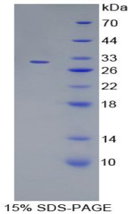 MAPK7 / ERK5 Protein - Recombinant Mitogen Activated Protein Kinase 7 By SDS-PAGE