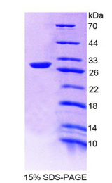 MAPKAPK2 / MAPKAP Kinase 2 Protein - Recombinant  Mitogen Activated Protein Kinase Activated Protein Kinase 2 By SDS-PAGE