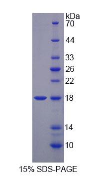 MARS Protein - Recombinant Methionyl tRNA Synthetase (MARS) by SDS-PAGE
