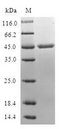 MB / Myoglobin Protein - (Tris-Glycine gel) Discontinuous SDS-PAGE (reduced) with 5% enrichment gel and 15% separation gel.