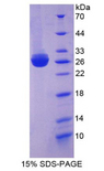 MBP / Myelin Basic Protein Protein - Recombinant Myelin Basic Protein By SDS-PAGE