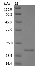 MCA32 Protein - (Tris-Glycine gel) Discontinuous SDS-PAGE (reduced) with 5% enrichment gel and 15% separation gel.